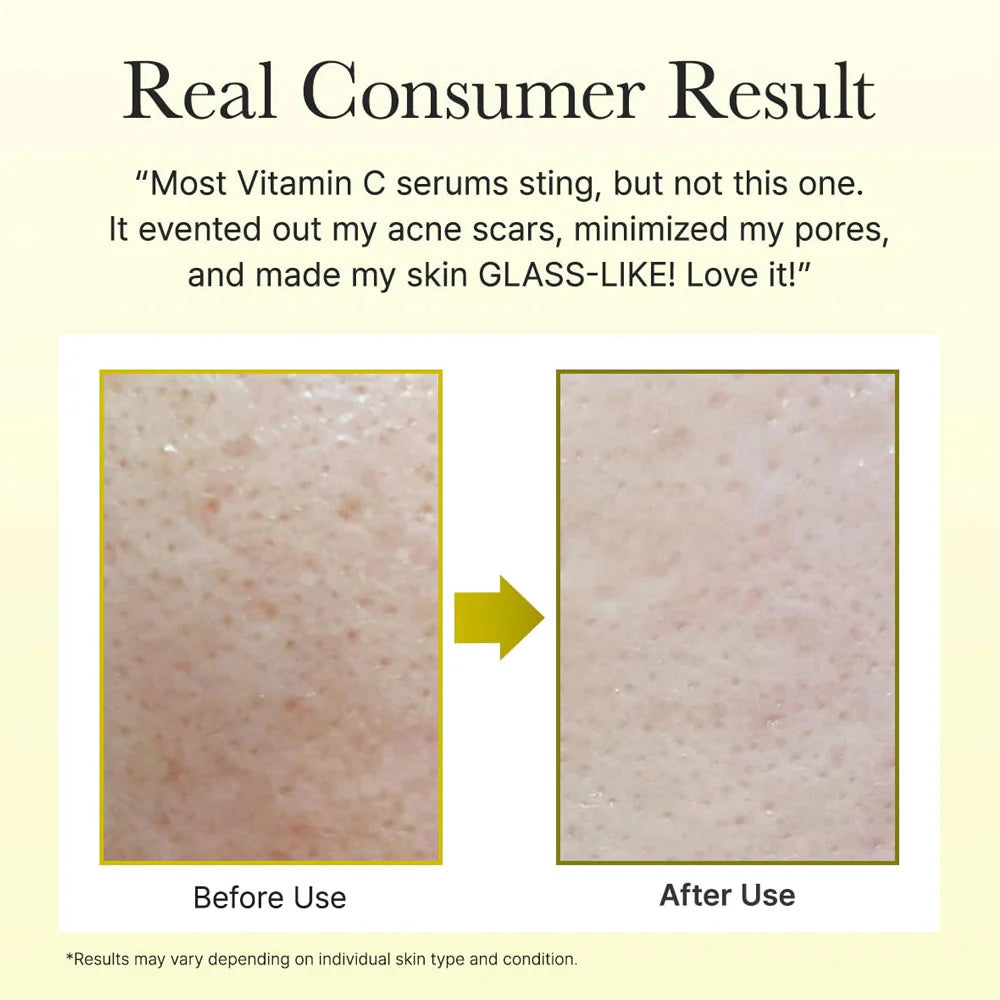 Arencia - Vitamin C Booster Shot